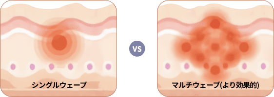Revive：シングルウェーブとマルチウェーブの比較