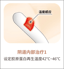 eleVaVa阴道内治疗第1步：温度设定为42~46°C