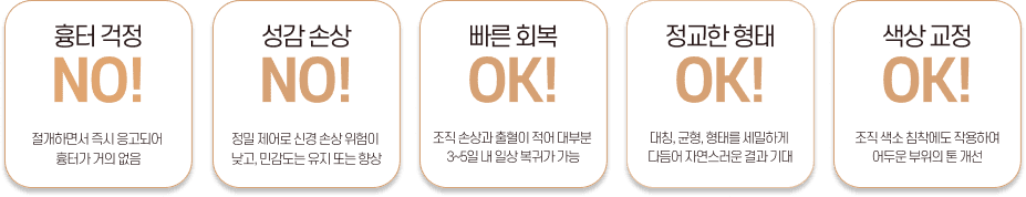 레이저 소음순 성형의 장점